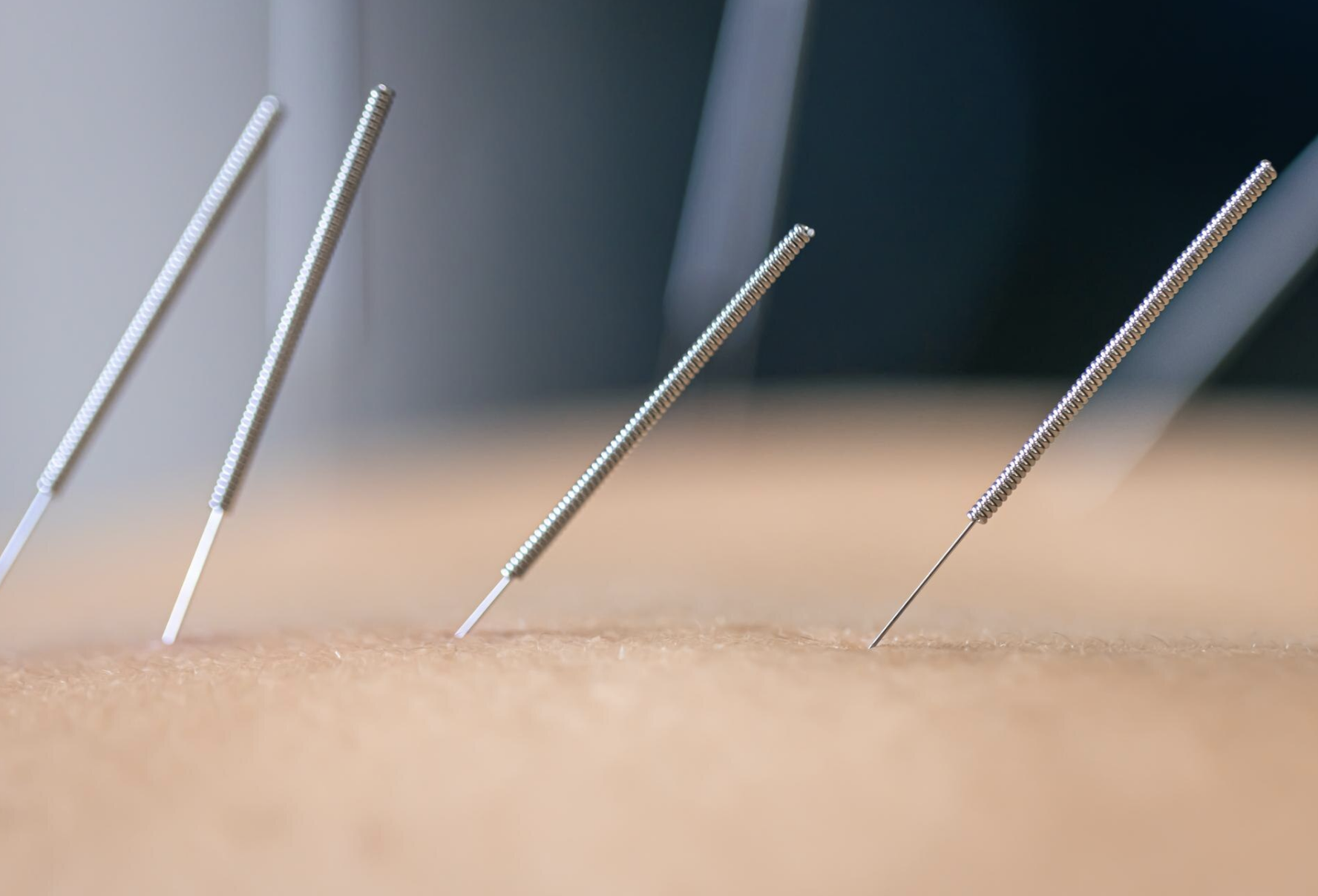 Dry Needling